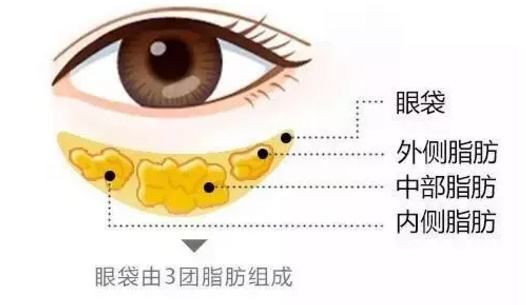 生活健康知识小常识：如何有效改善眼袋