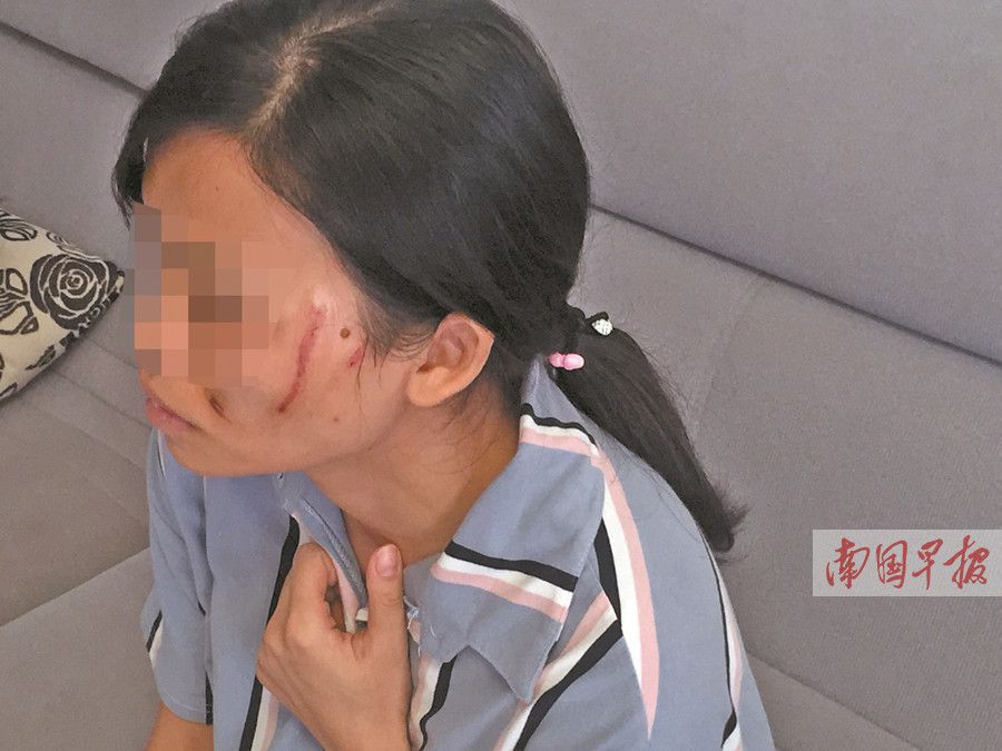 母子因车位纠纷将邻居打成脑震荡：登门道歉赔3万